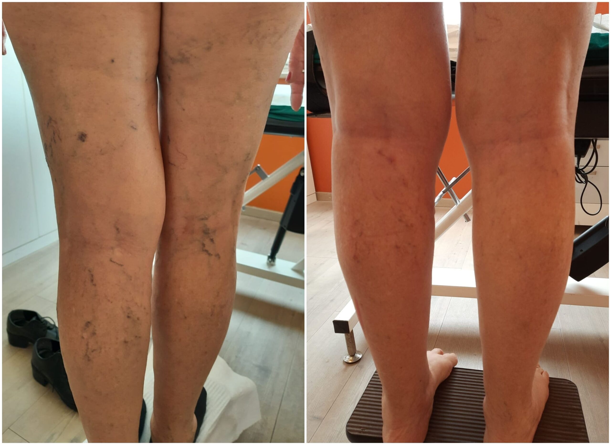 Recensione NutriLegs