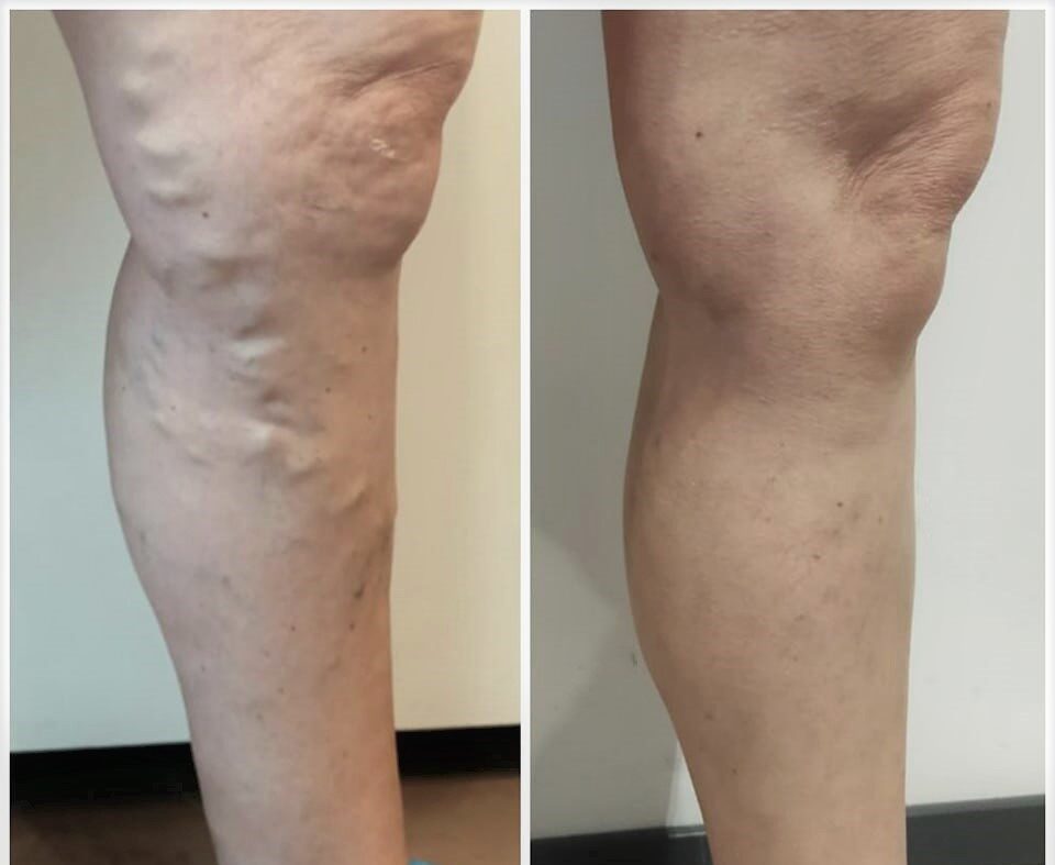 Recensione NutriLegs